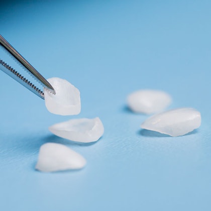 forceps holding a veneer plate