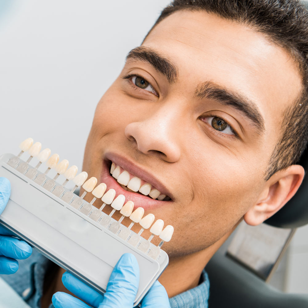 Smiling young man checking veneer shades
