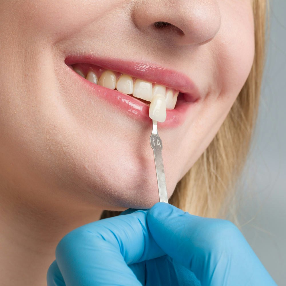 Smiling woman comparing veneers