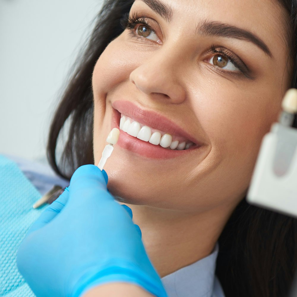 Smiling veneers patient