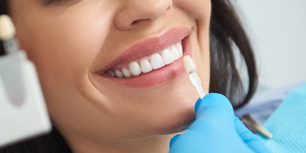 Woman with porcelain veneer shade
