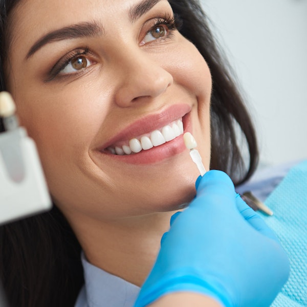 woman trying on veneers