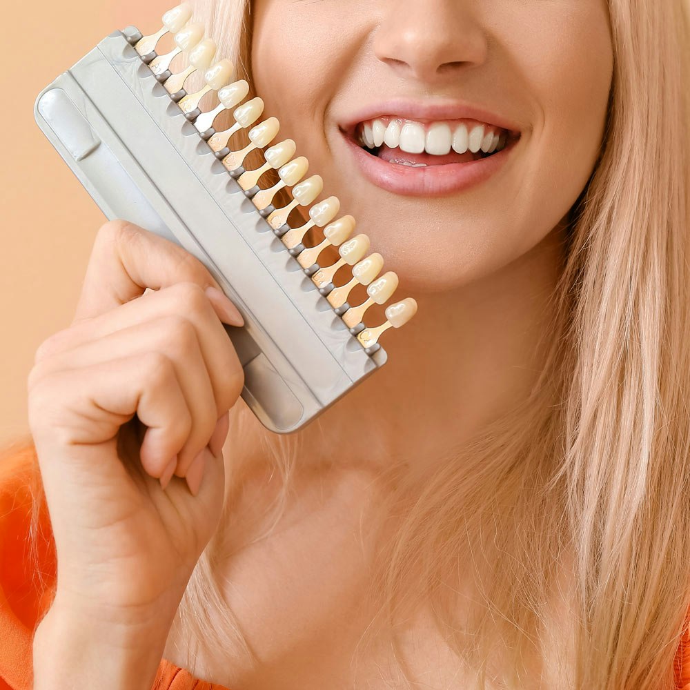 Woman holding veneers shades