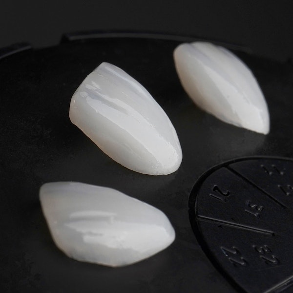 Three porcelain veneers