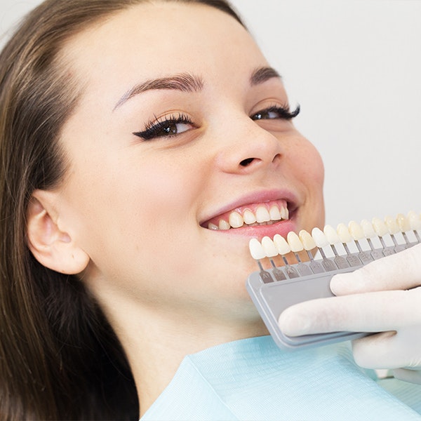 Shade guide next to woman's mouth