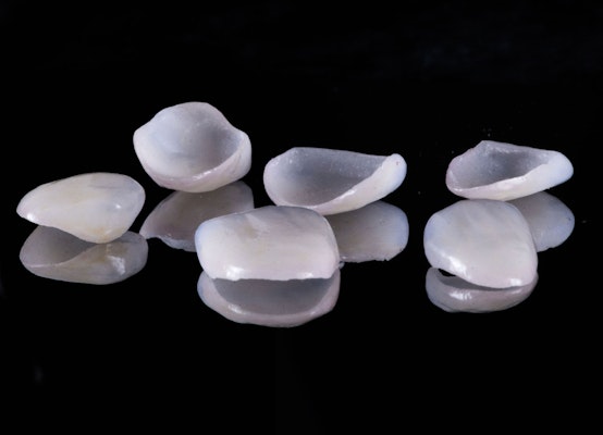 Porcelain veneers