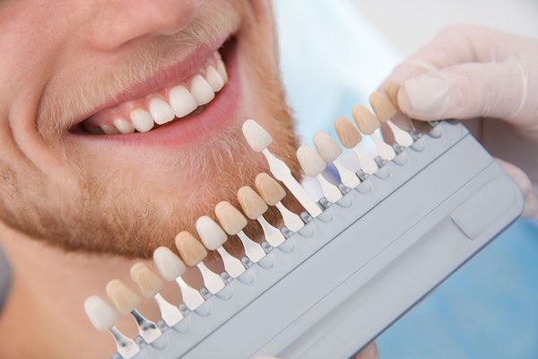 Dentist comparing veneer shades against patient's teeth