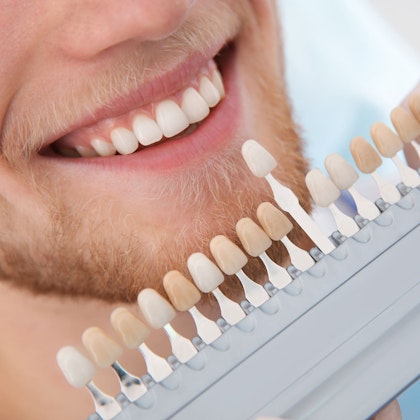 Man comparing veneer shades