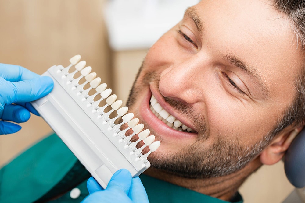Man with veneers