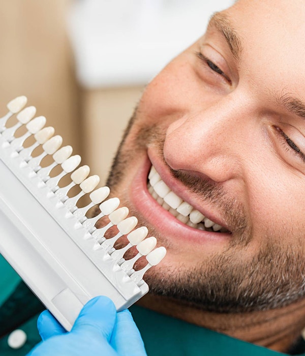 Man comparing multiple veneers shades