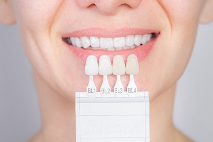 porcelain veneers shade guide against teeth