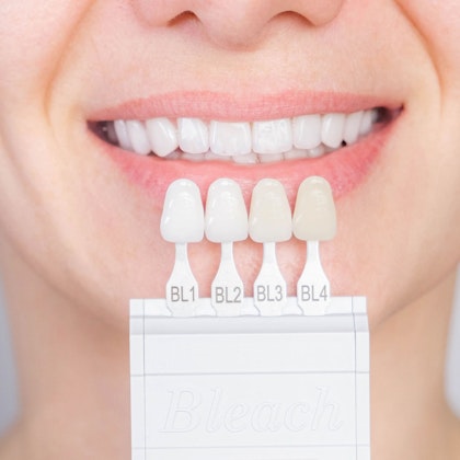 porcelain veneers shade guide against teeth
