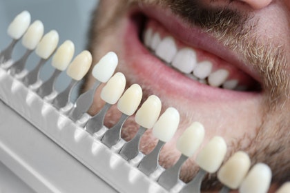dentist holding up a enamel comparison chart against man's smile