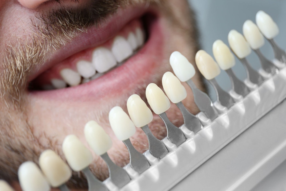 Man smiling with veneer shades