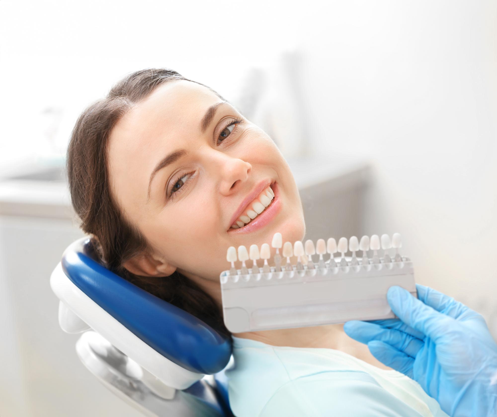 Woman with veneers shades