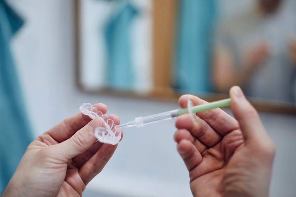 person applying bleaching gel to at-home teeth whitening tray