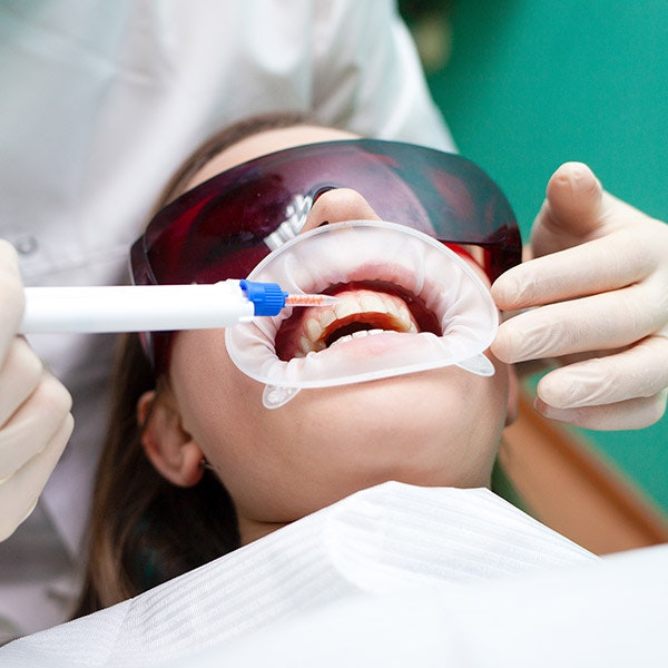 Teeth Whitening in-office