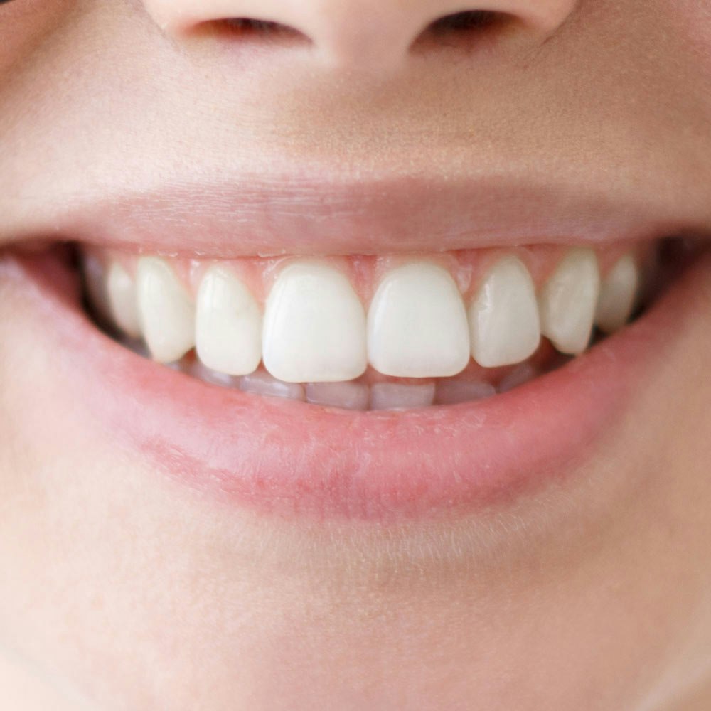 White smile