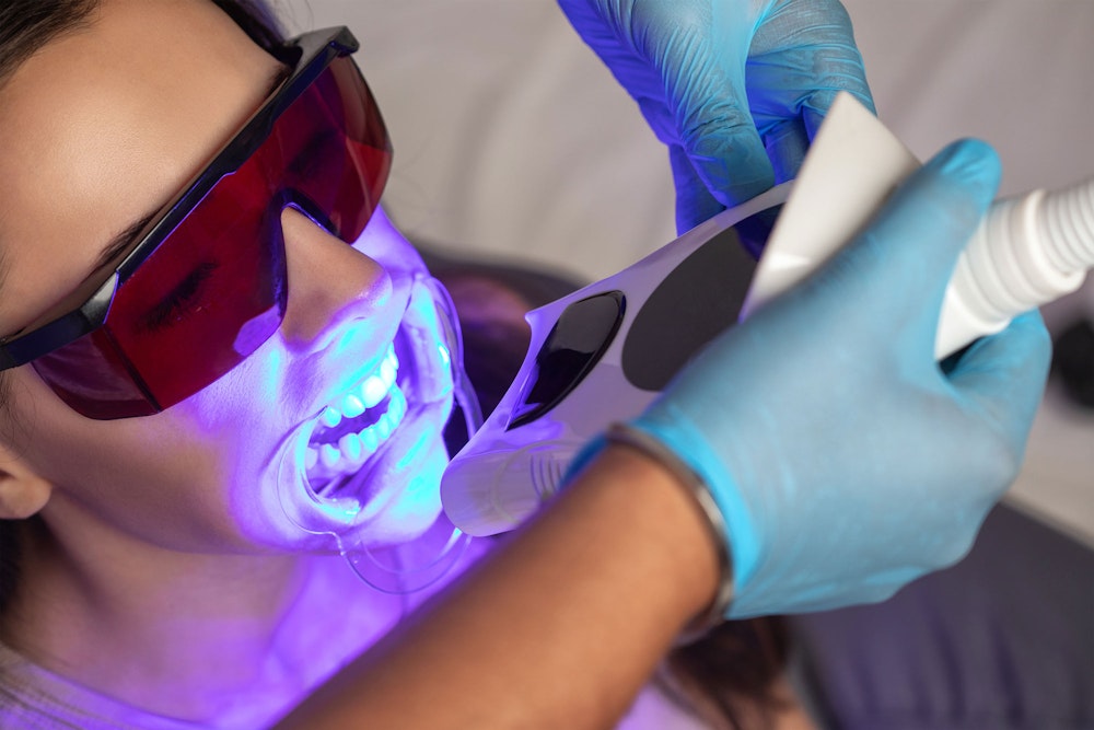 Woman going through in-office Zoom! whitening procedure