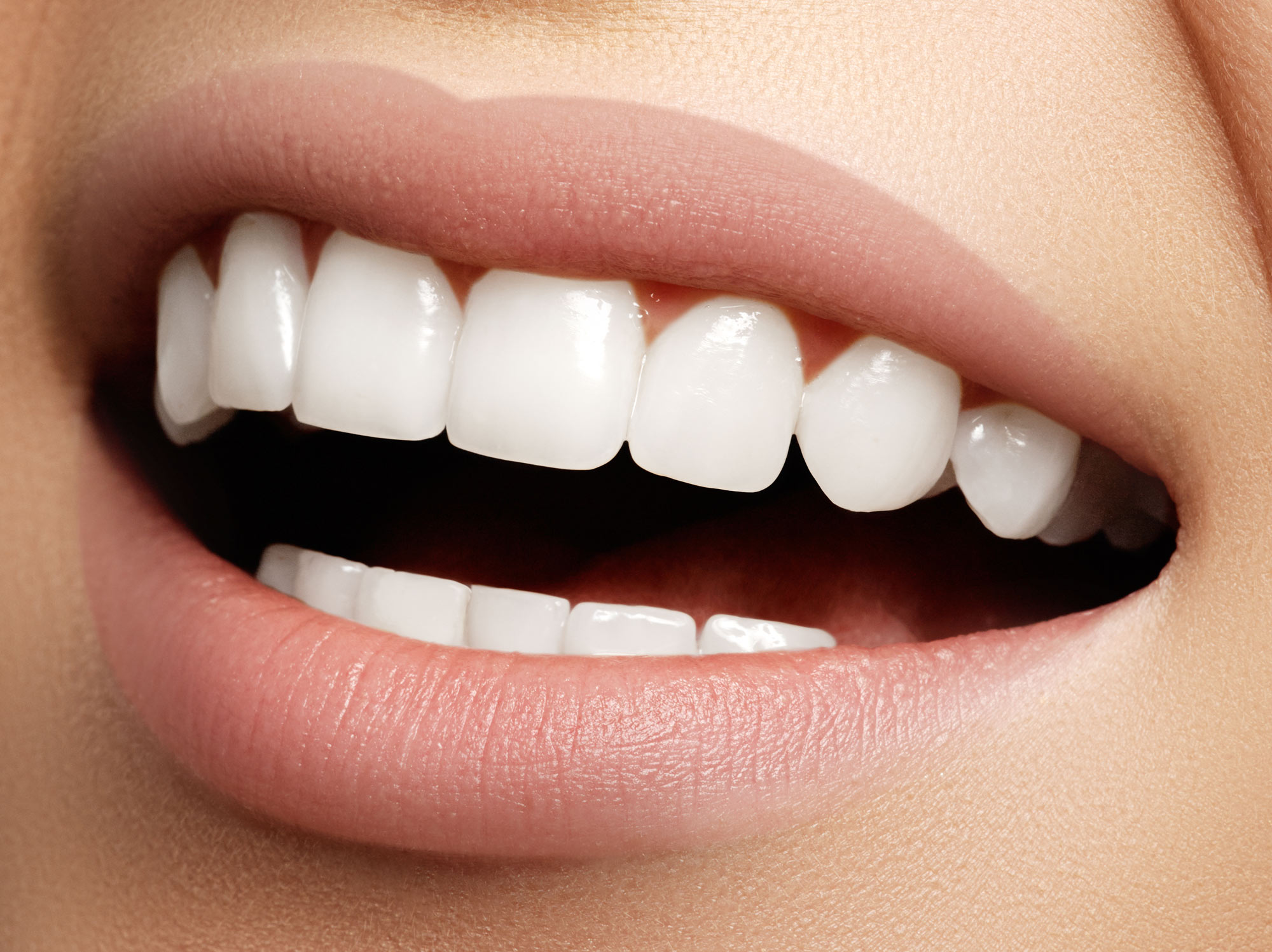 Teeth Whitening Mitchellville Md Silver Spring Md Bowie Md 4166