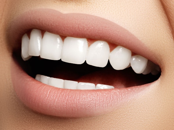 Close-up of a cosmetic dentistry patient's bright smile
