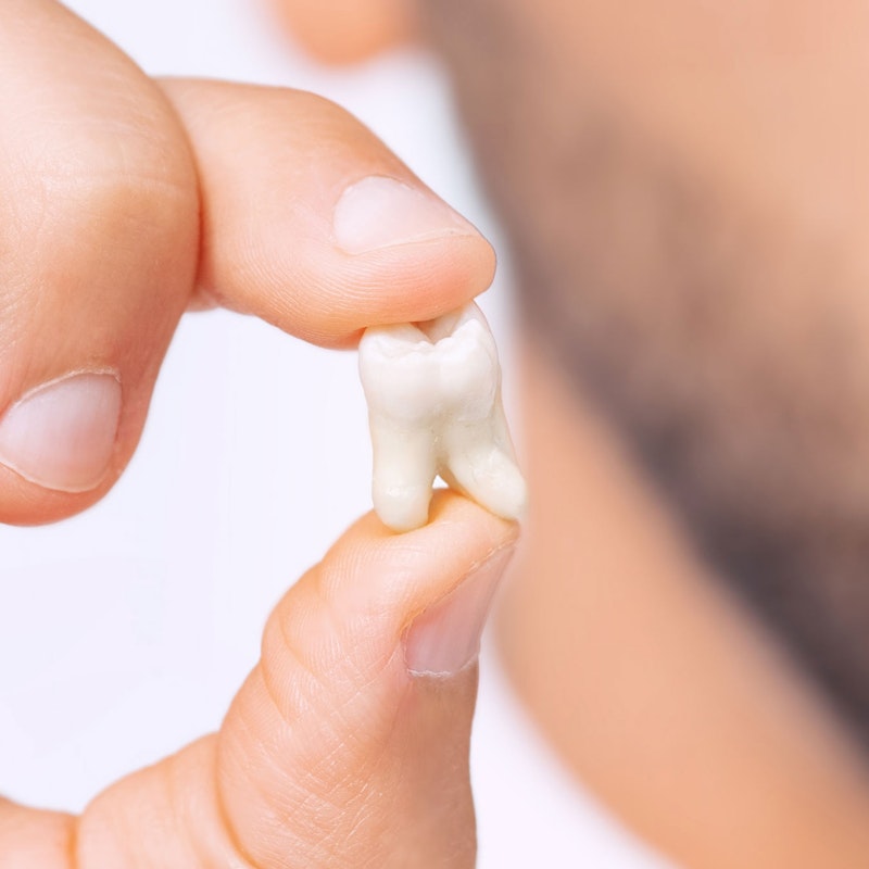 Hand holding an extracted tooth
