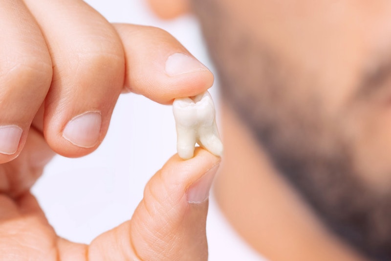 Hand holding an extracted tooth