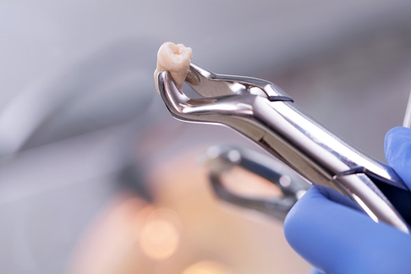 Tooth extraction