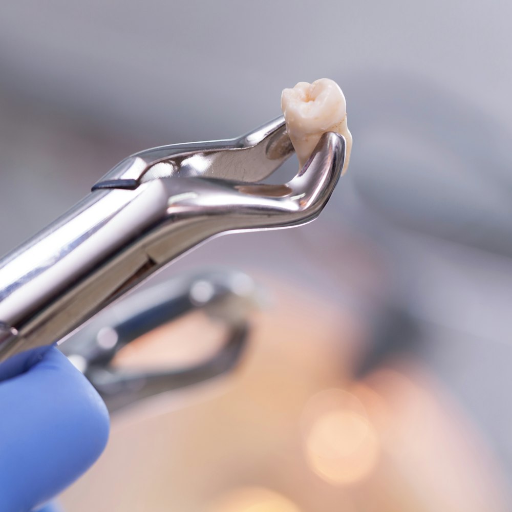 Dental extraction