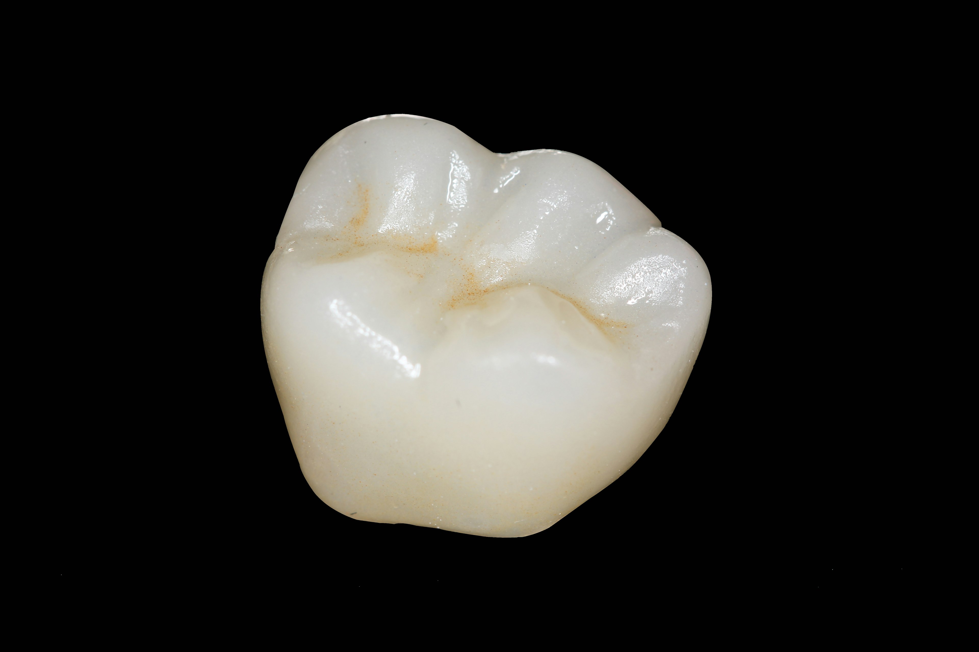 Photo of dental crown